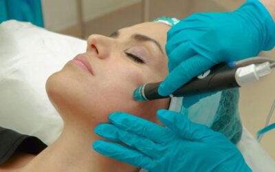 10 Beneficios del Hidrodermoabrasión en Fuengirola para una Piel Radiante