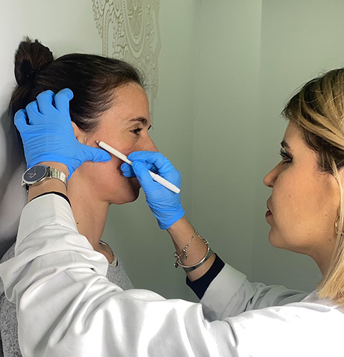 Inductores de colageno en Fuengirola