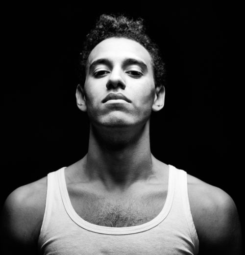 Skinbooster en Fuengirola