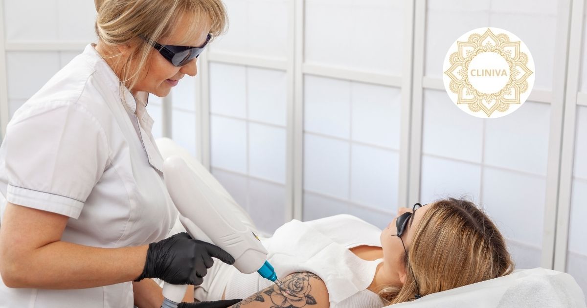 Eliminación de tatuajes con láser: borrado eficaz y seguro en Fuengirola