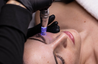 Mesoterapia Corporal en Costa del Sol: Guía Completa